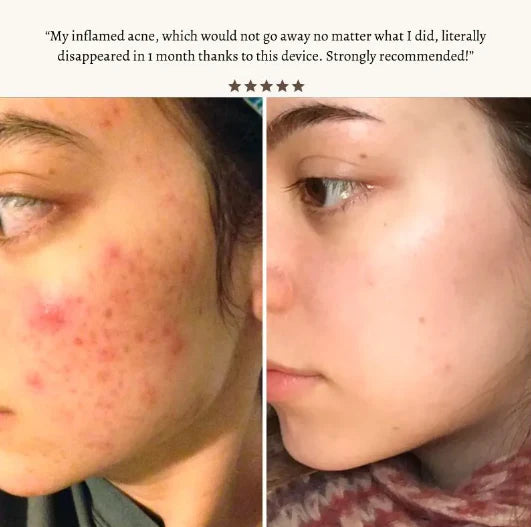 StyleSparkz Professional Grade Electrotherapy Beauty Wand 6pc Set