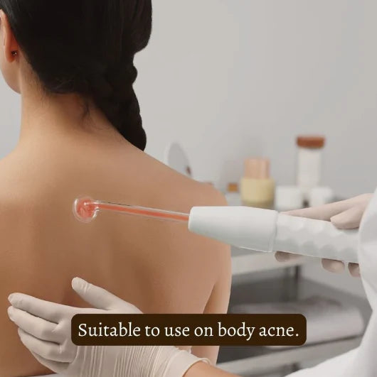 StyleSparkz Professional Grade Electrotherapy Beauty Wand 6pc Set