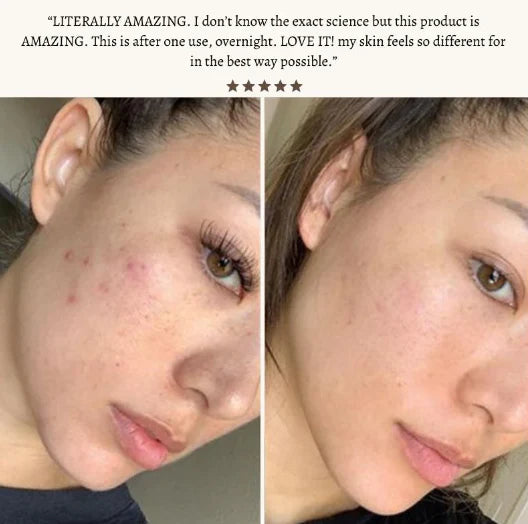 StyleSparkz Professional Grade Electrotherapy Beauty Wand 6pc Set