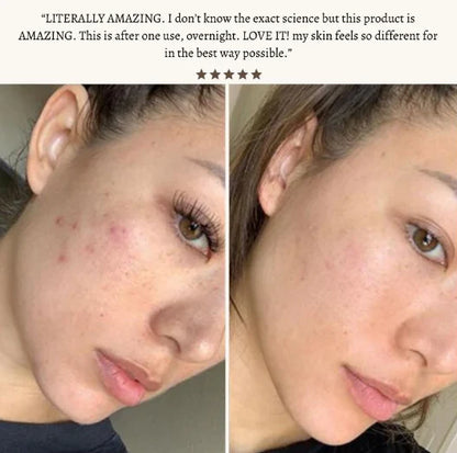 StyleSparkz Professional Grade Electrotherapy Beauty Wand 6pc Set