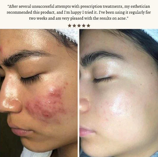 StyleSparkz Professional Grade Electrotherapy Beauty Wand 6pc Set