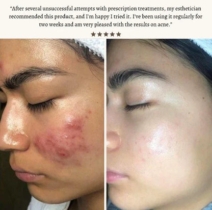 StyleSparkz Professional Grade Electrotherapy Beauty Wand 6pc Set