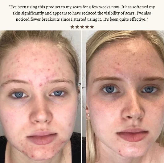 StyleSparkz Professional Grade Electrotherapy Beauty Wand 6pc Set