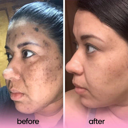 Stylesparkz Kojic Acid & Tumeric Cleansing Pads