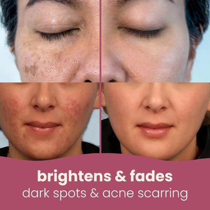 Stylesparkz Kojic Acid & Tumeric Cleansing Pads