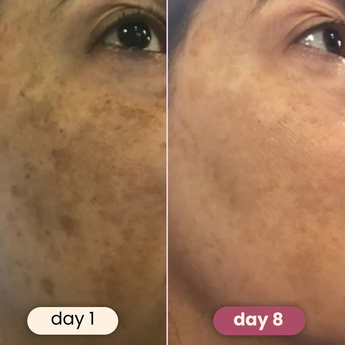 Stylesparkz Kojic Acid & Tumeric Cleansing Pads