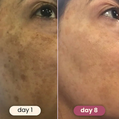 Stylesparkz Kojic Acid & Tumeric Cleansing Pads