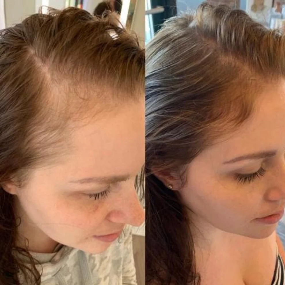 StyleSparkz 5% Minoxidil Advanced Formula Hair Growth Serum