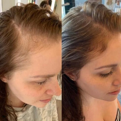 StyleSparkz 5% Minoxidil Advanced Formula Hair Growth Serum