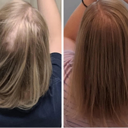 StyleSparkz 5% Minoxidil Advanced Formula Hair Growth Serum