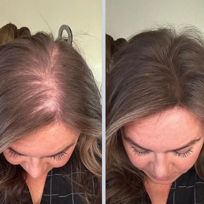 StyleSparkz 5% Minoxidil Advanced Formula Hair Growth Serum